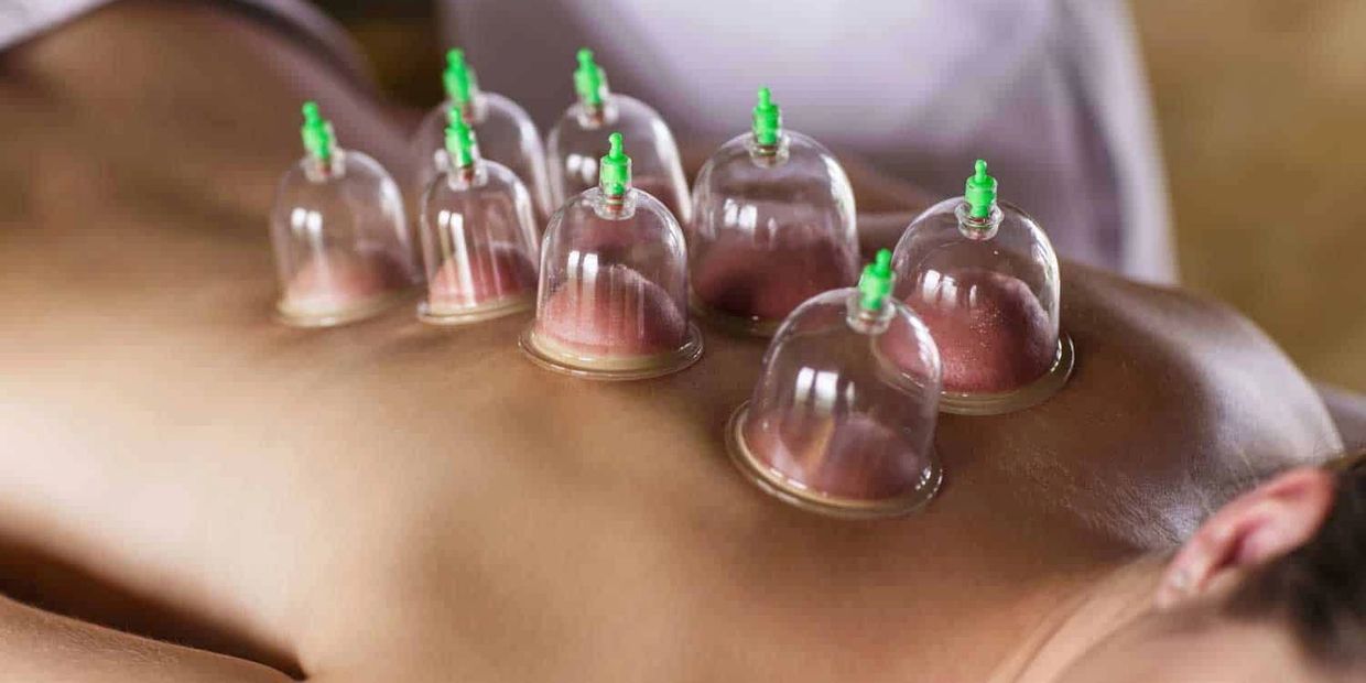 Cupping Therapy at LondonCombat MMA Academy