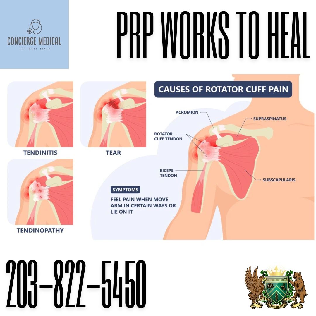 Shoulder Pain Help: PRP for Rotator Cuff Tears