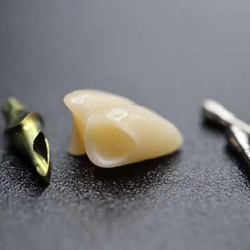Cementable implant crowns offer flexibility with regard to the positioning of the implant which make