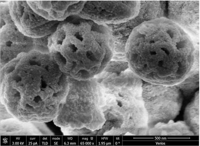 Dendritic Mesoporous silica Nanoparticles 