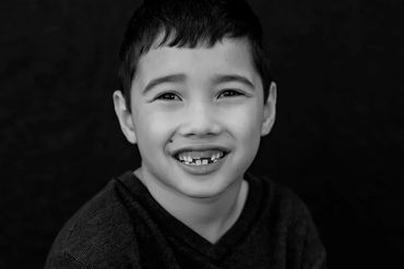 Five years old  boy missing his two front teeth