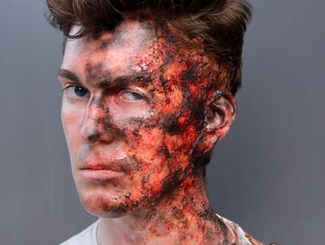 Out of kit third degree burn on one side of the face of the male model