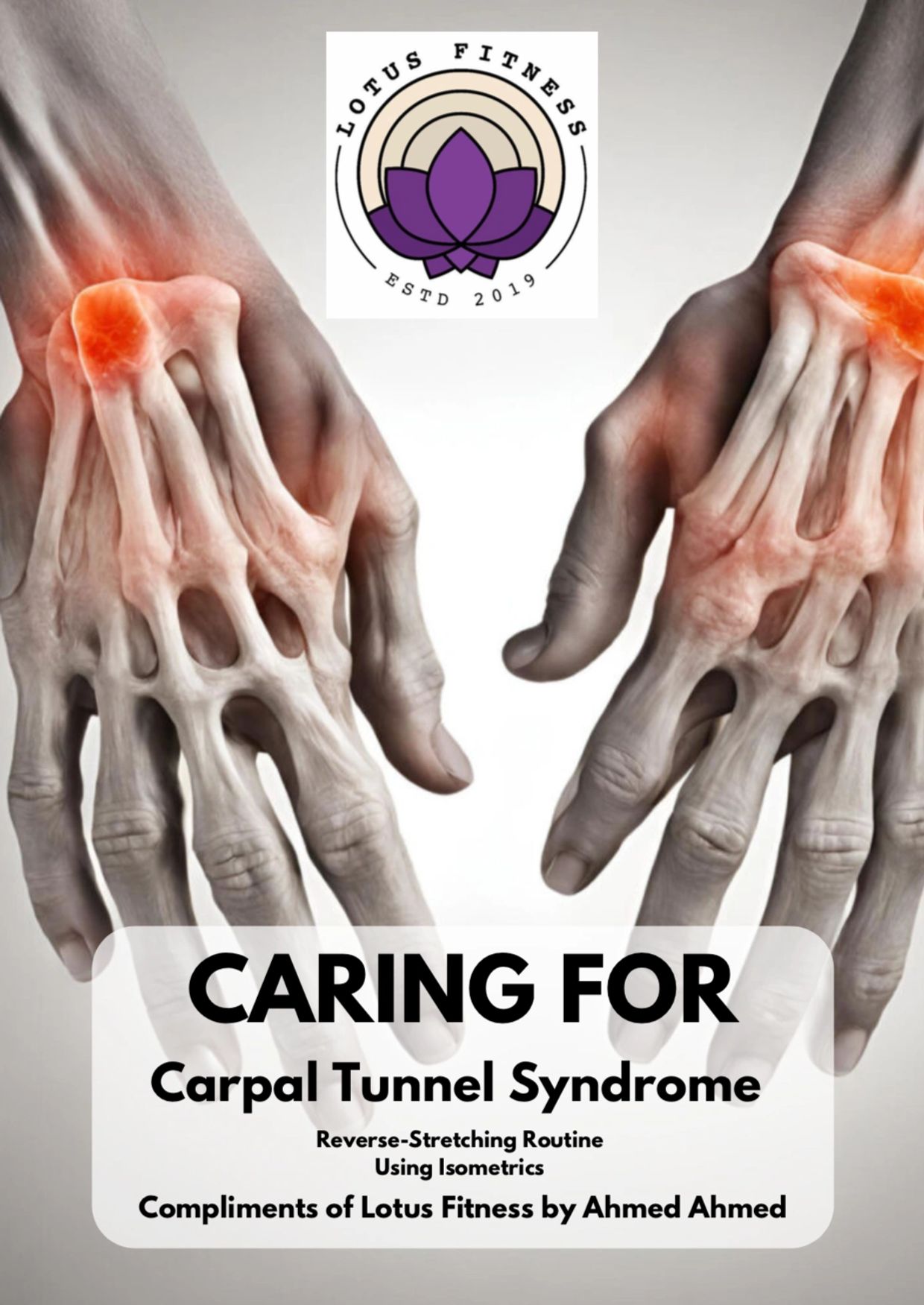 Visual of hand bones highlighting carpal tunnel syndrome areas with Lotus Fitness logo.