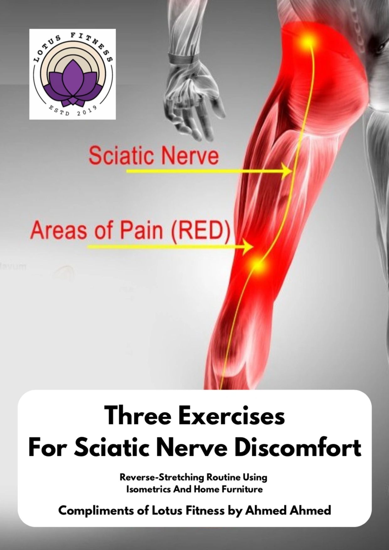 Diagram showing sciatic nerve pain areas and exercises for relief.