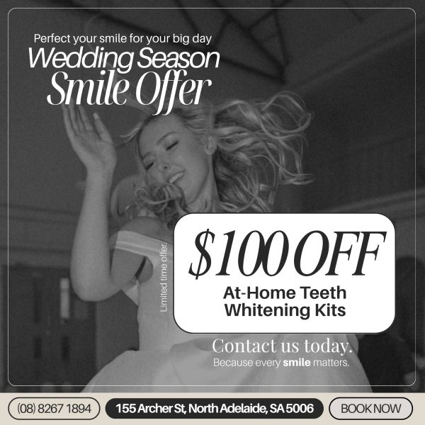 Wedding season smile offer: $100 off at-home teeth whitening kits.