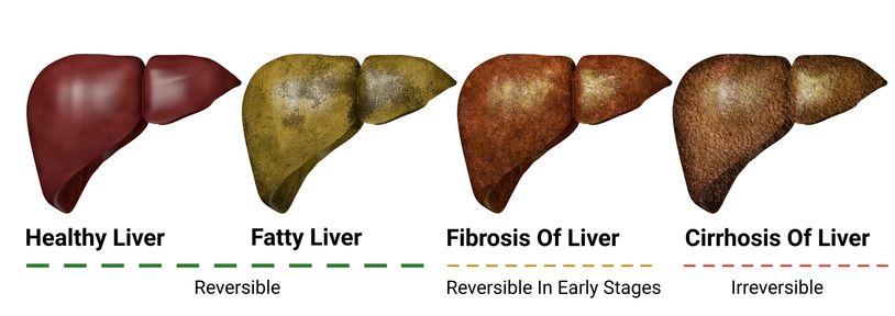 Liver Health Scan