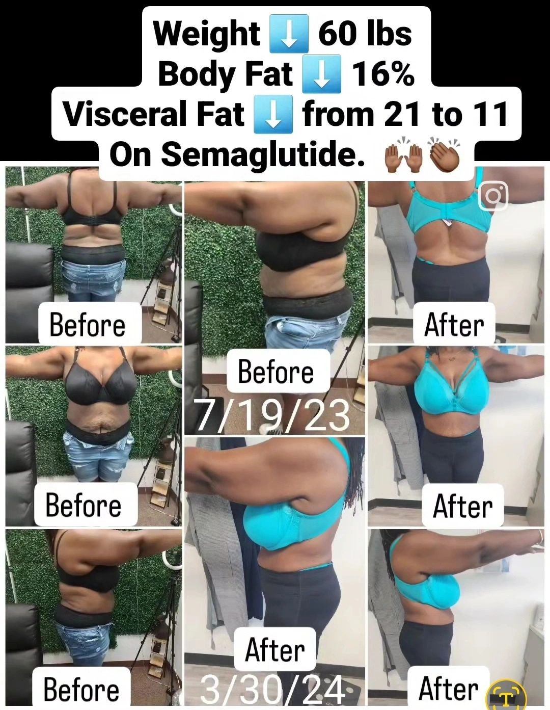 how long is tirzepatide good for What to Expect on Tirzepatide: Month-by-Month Weight Loss Timeline