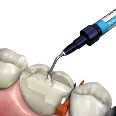 Dental Experts, Best Dental Surgeon
Special Dental Treatment