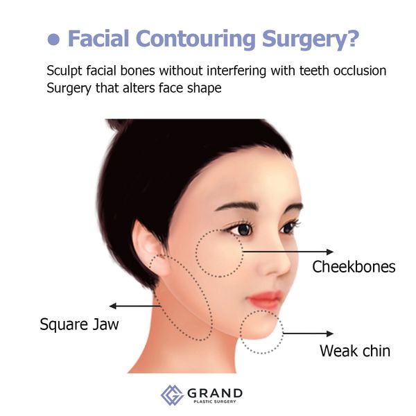 Jaw Recontouring, Angle Reduction, V-Line Face - Tes Clinic for Face and Jaw