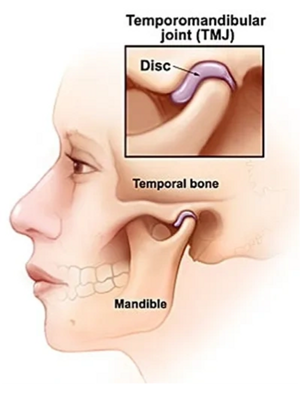 How Does a TENS Unit Help With TMJ (Temporomandibular Joint) Pain?