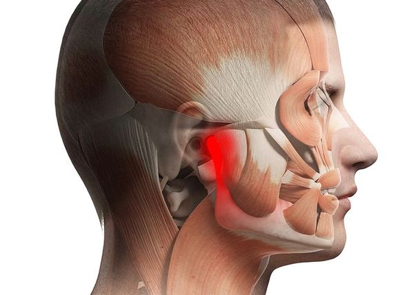 Temporomandibular Joint, TMD, TMJ Surgery, Best TMJ Surgeon in India, Splint therapy, Bruxism, Pain