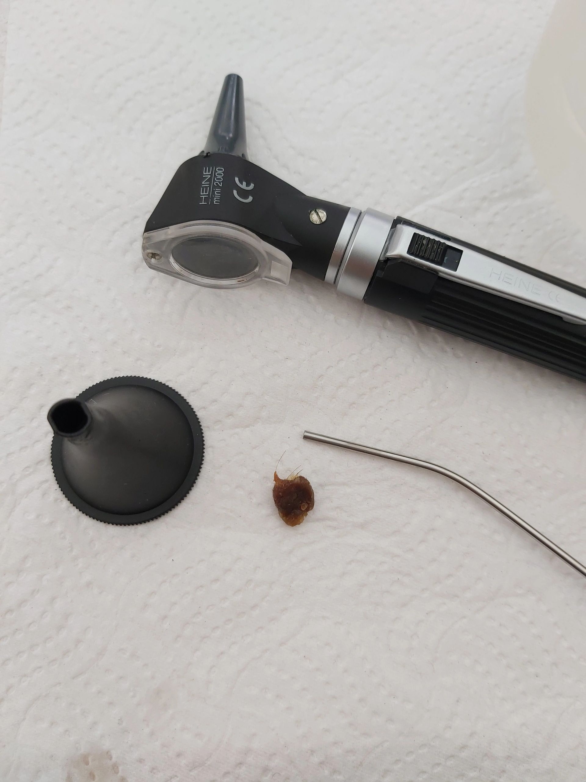 What is ear wax and why does it cause us problems?