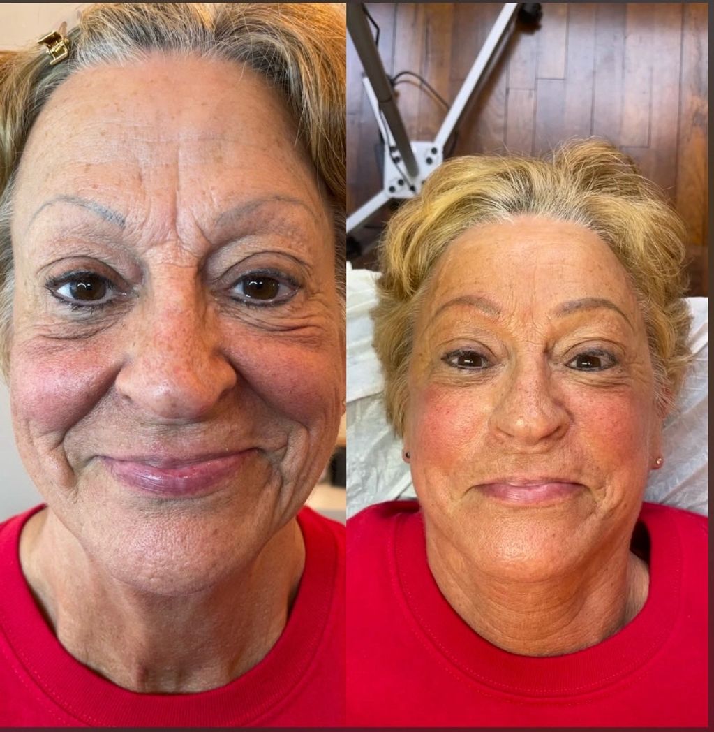 Before and after Powder Brow Camouflage