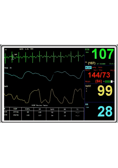 Patientenmonitor mit EKG Aufzeichnung