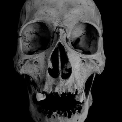 human skull