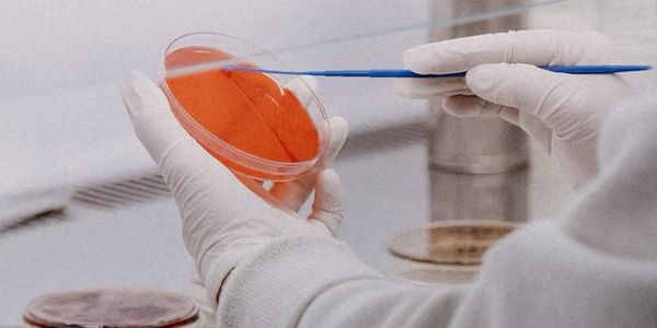 Scientist handling a petri dish with a culture swab in a lab.
