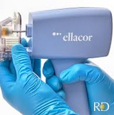 Ellacor RF micro-coring to reduce wrinkles and tighten skin, stimulate new collagen and elastin
