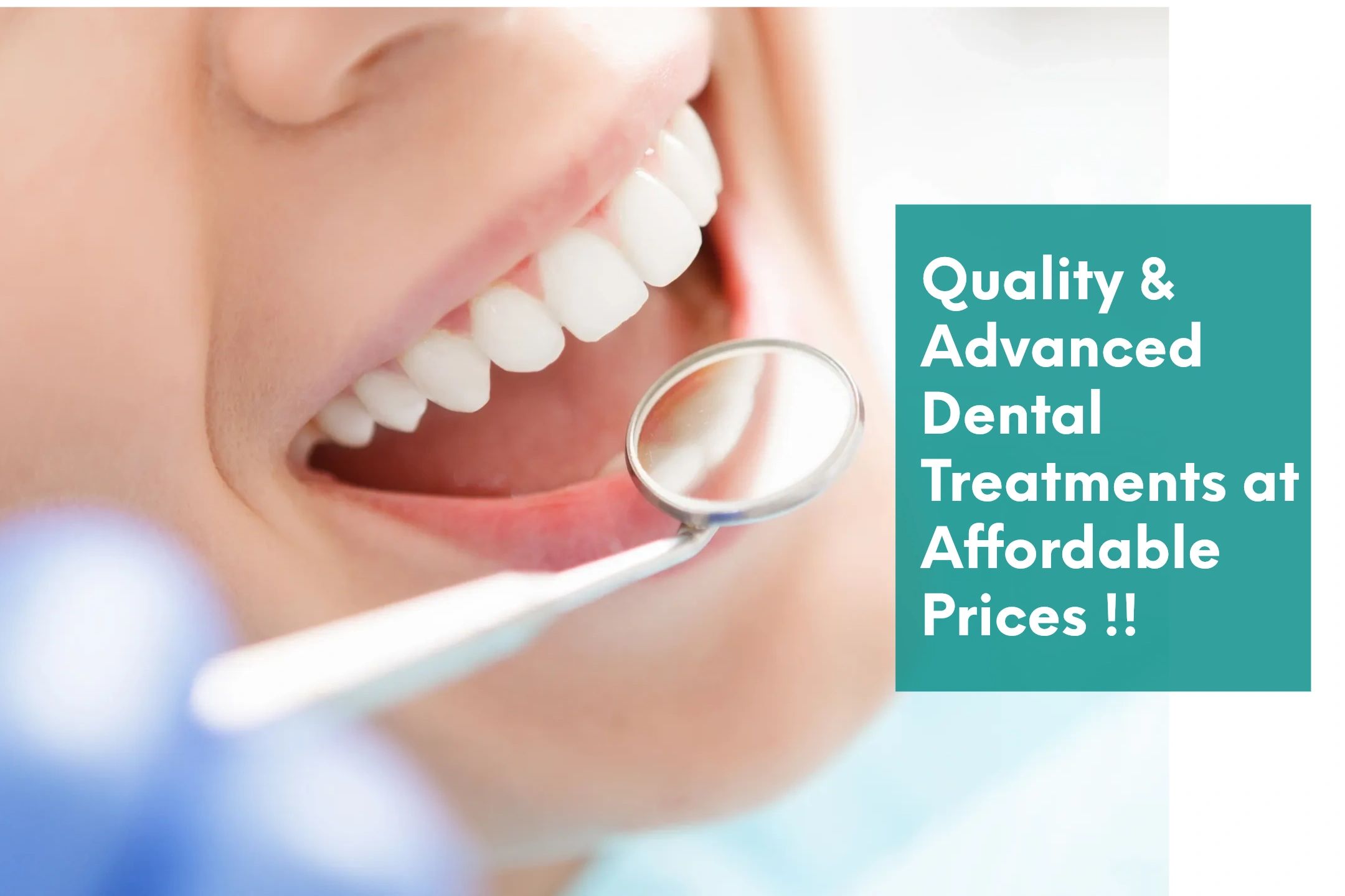 top dental implants in Dwarka: This Is What Professionals Do Beware The top dental implants in Dwarka Scam