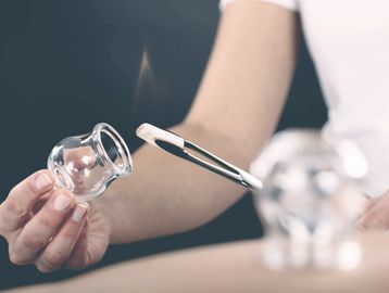 CHINESE FIRE CUPPING