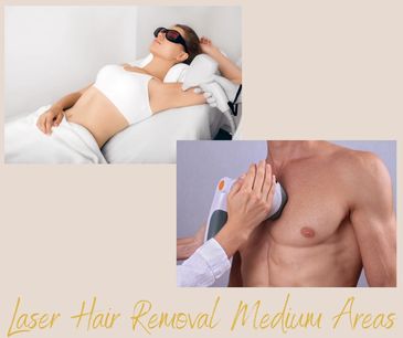 Laser hair removal treatment on underarm and chest areas.