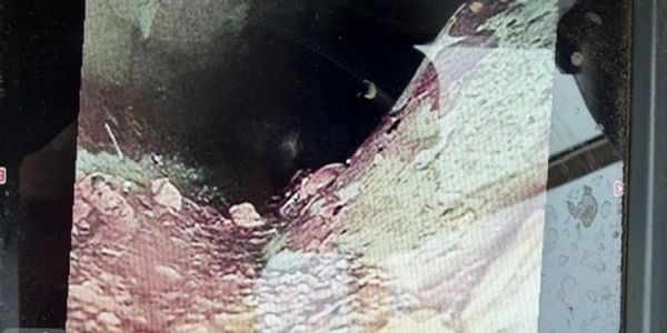 Ultrasound image showing a dark cavity with surrounding tissue.