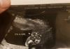 It’s a girl!