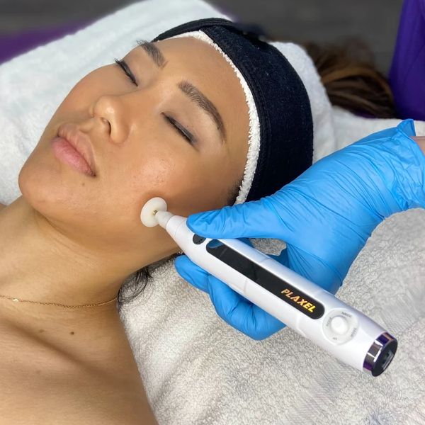 Woman receiving a facial treatment with a Plaxel device.