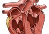 Equine Heart Inner