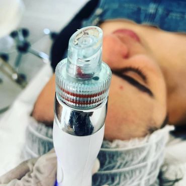 Hydro dermabrasion 