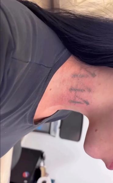 Close-up of a person's neck with a faded tattoo and long dark hair.