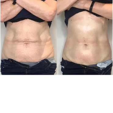 Post 3 Sessions