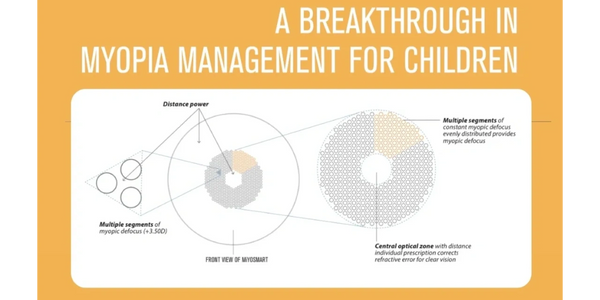 Myopia management to  control the progression of nearsightedness in children