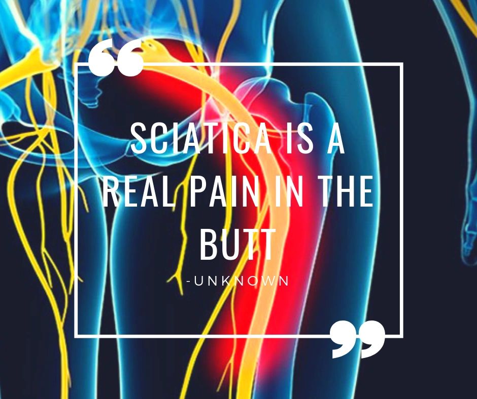 What You Need to Know About Sciatica