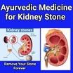 Ayurvedic Medicine for kidney stone 