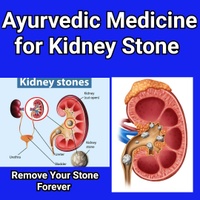 Ayurvedic Medicine for kidney stone 