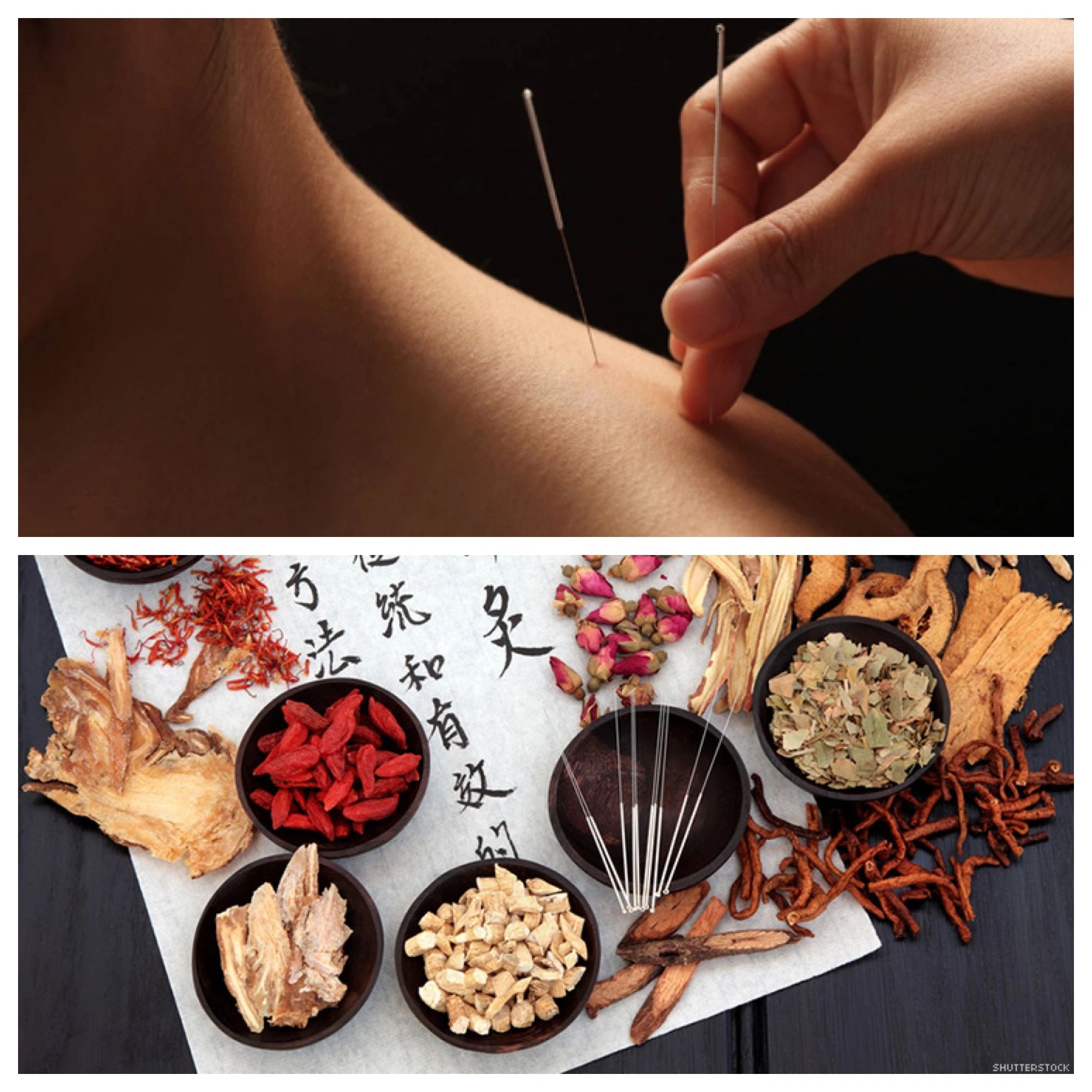 Bloom Acupuncture Chicago Acupuncture, Alternative Medicine Bloom Acupuncture Chicago