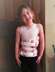 كيف يؤثر الشكل الجمالي لحزام اعوجاج العمود الفقري على الالتزام بالعلاج؟