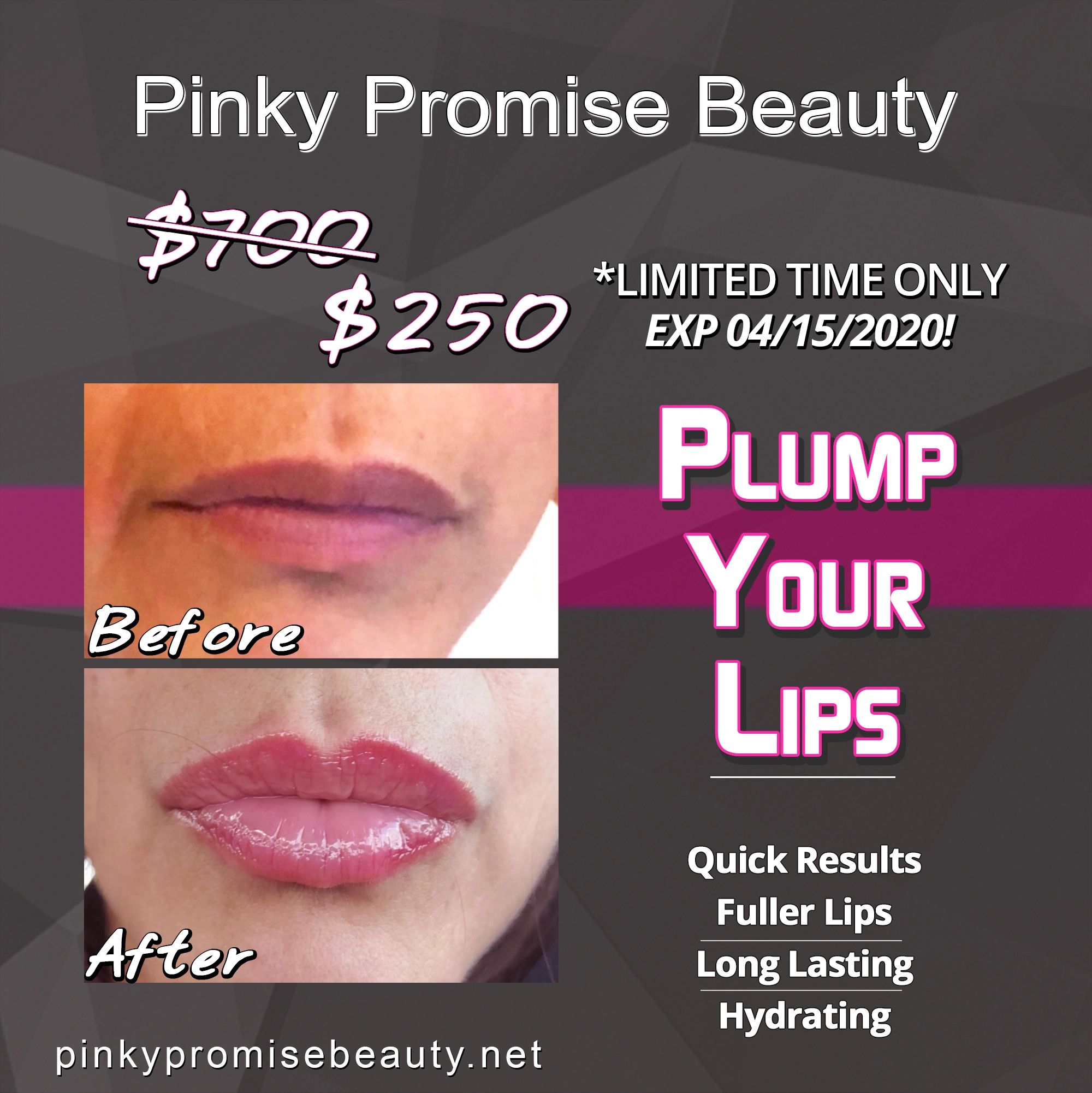 Pinky Promise Beauty - Fat Freeze - Logan Square, Illinois | Pinky ...