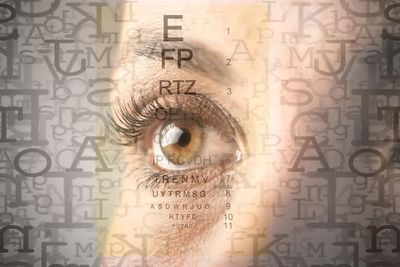 Myopia control Eye exam 
