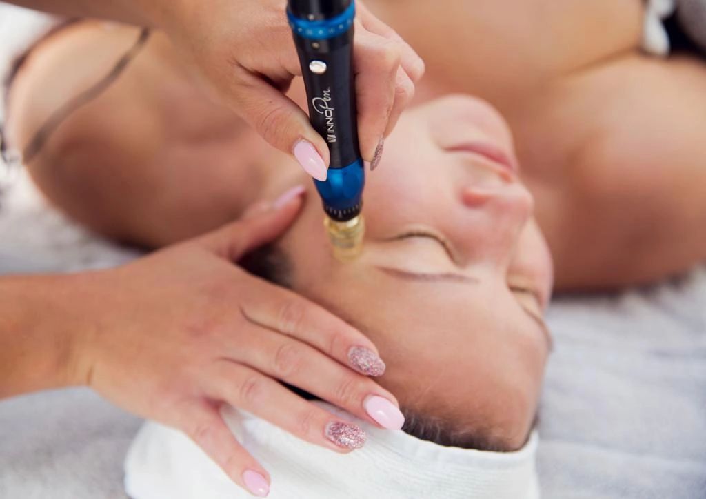 Micro needling or CIT( collagen induction therapy)
