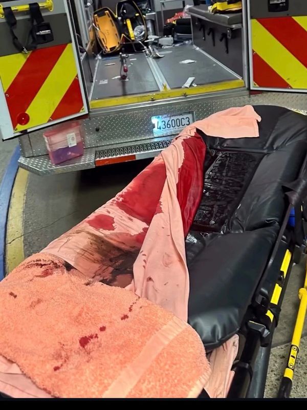 Blood-stained stretcher outside ambulance with medical equipment inside.