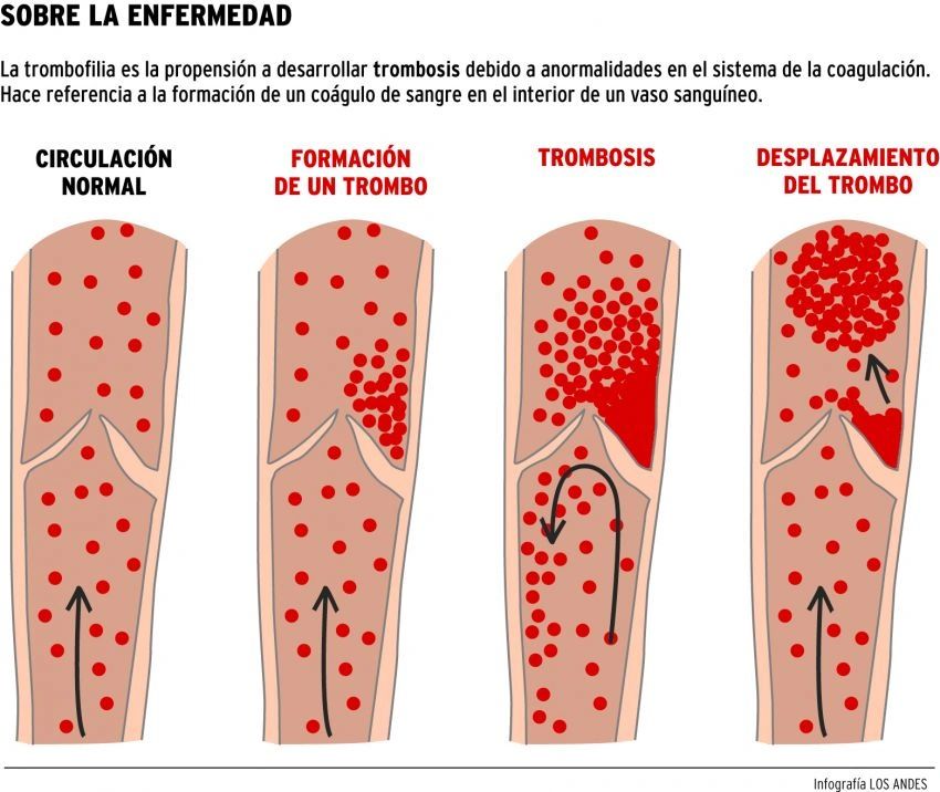 Trombofilia y trombosis