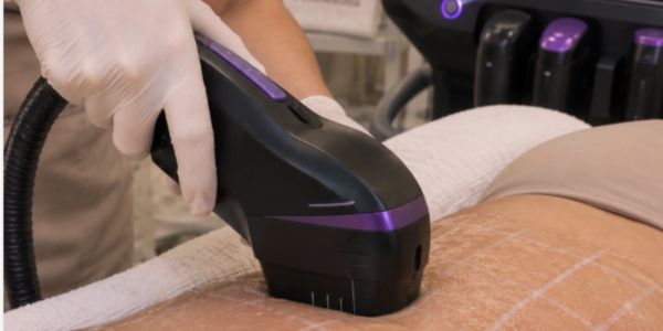 Tratamiento estético con máquina en la piel.