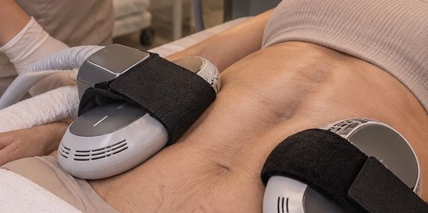 Tratamiento de Emsculpt en abdomen para tonificar.