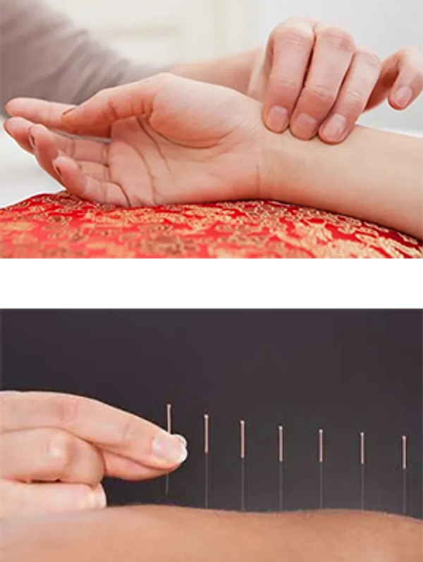 Acupuncture Acupuncture Near Me