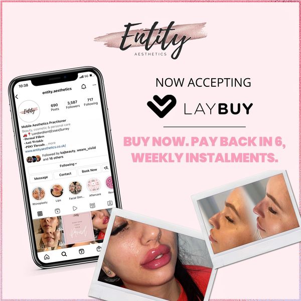 Buy Now Pay Later  Entity Aesthetics