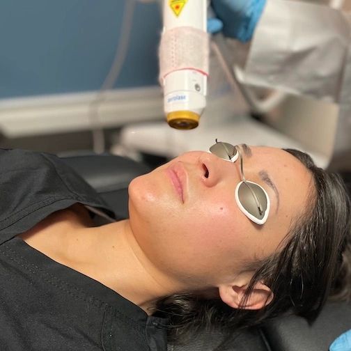 Laser Skin Rejuvenation Treatment in Redlands, CA