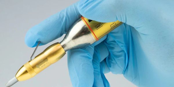 cryotherapy of wart or verruca 