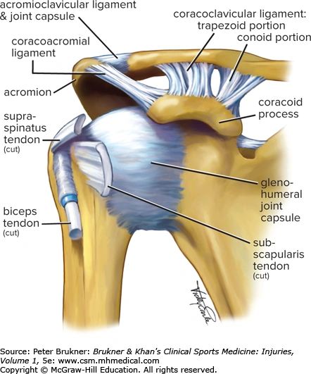 Ombord Beskæftiget aluminium Acromioclavicular Joint Sprains and Common Problems