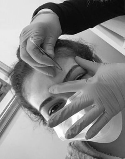 A woman getting her eyebrows shaped at a clinic 